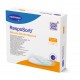 Hartmann Resposorb Silicone Border Sacrum Αυτοκόλλητα Επιθέματα Κατακλίσεων για τον κόκκυγα 18x18 cm - 1 τεμάχιο Hartmann Resposorb Silicone Border Sacrum Αυτοκόλλητα Επιθέματα Κατακλίσεων για τον κόκκυγα 18x18 cm - 1 τεμάχιο