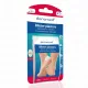 Deramed Επιθέματα gel για ερεθισμούs 07-2-066 F059/1