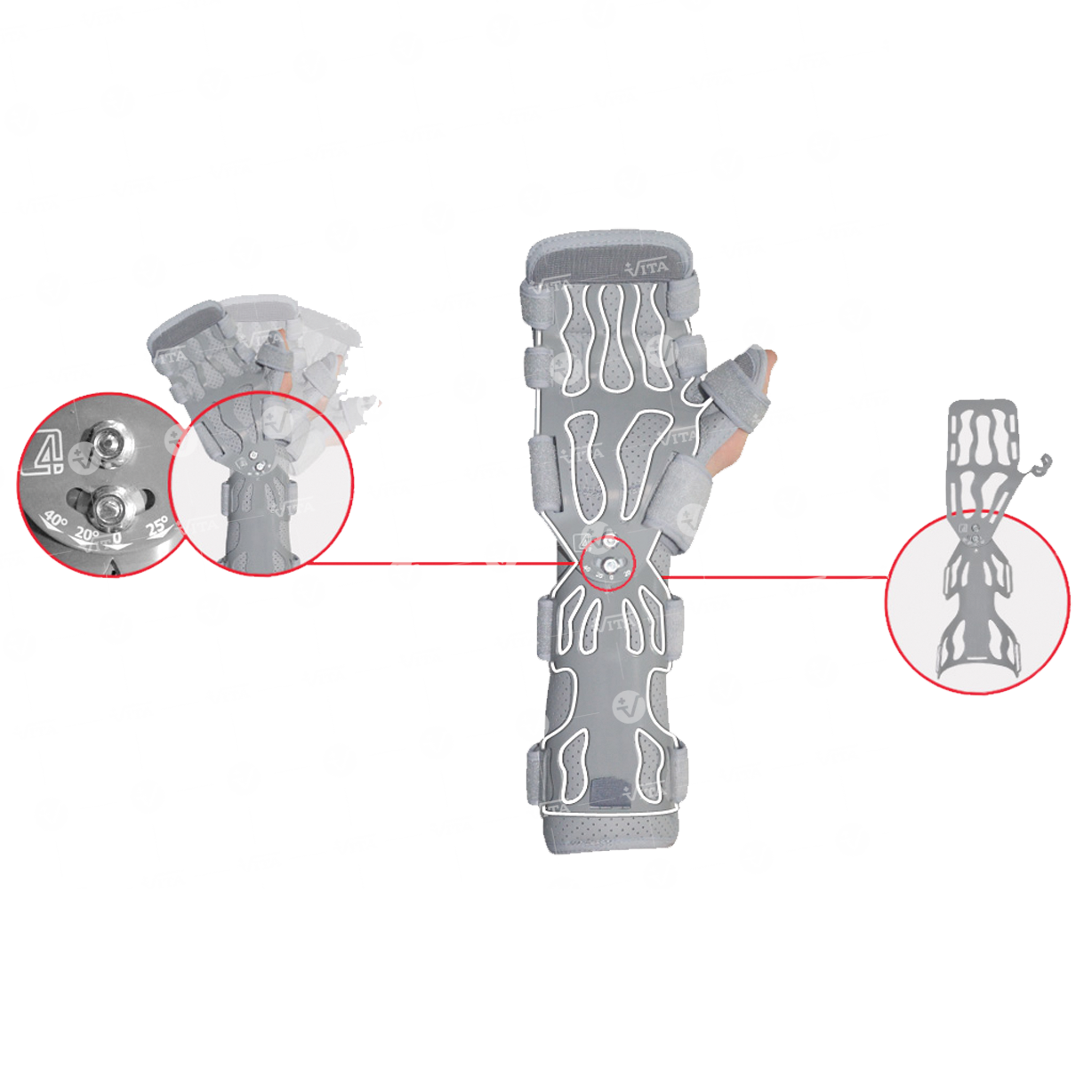 Νάρθηκας Λειτουργικός Άκρας Χειρός 03-2-063 VITA ORTHOPAEDICS Αριστερό